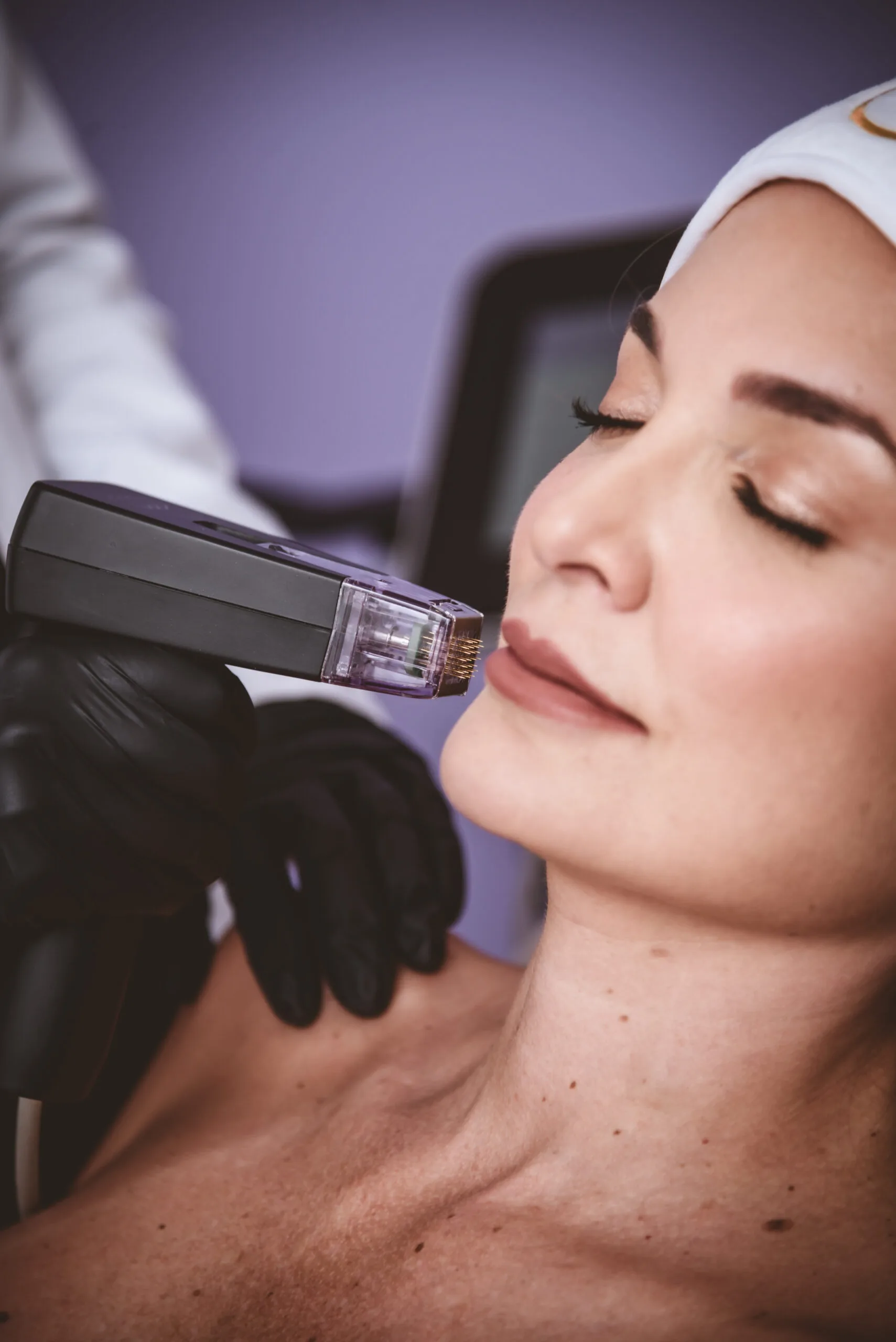 Personalized facial treatment protocol at Total Definer Beauty Longevity Clinic in Bogotá