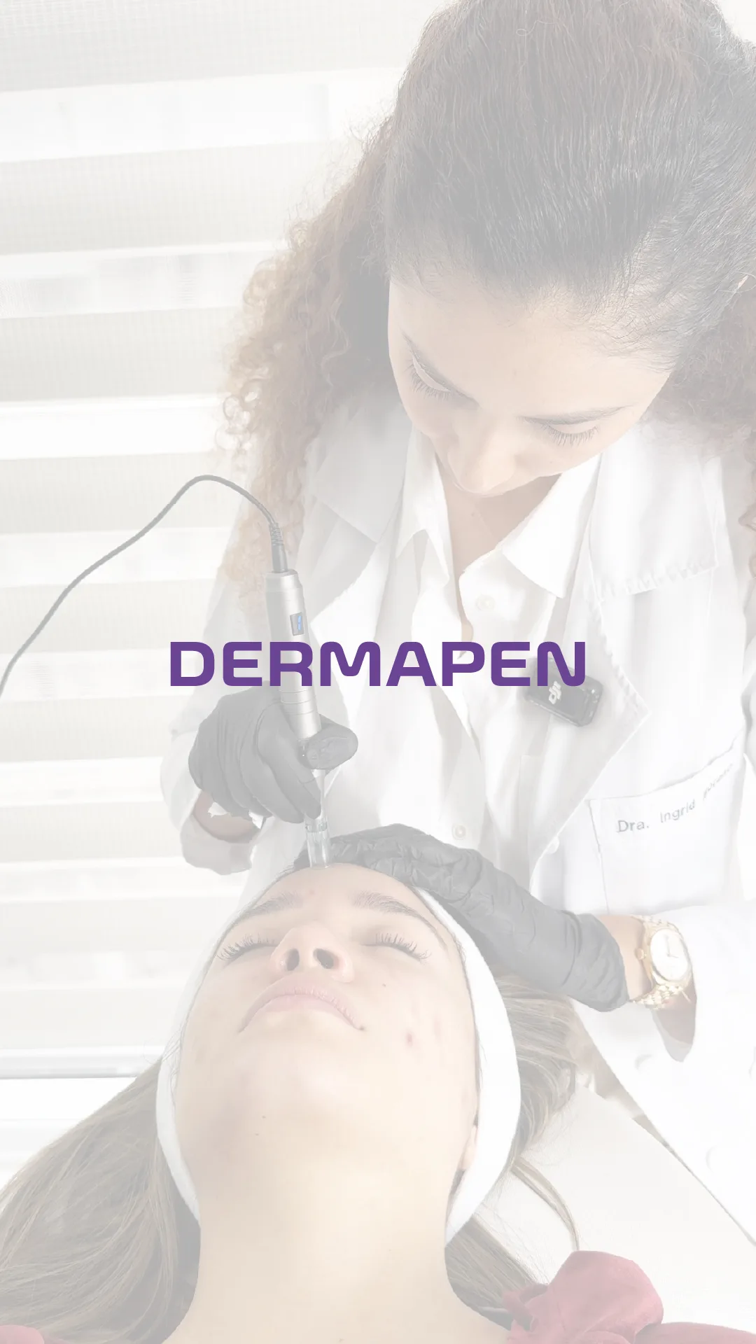 dermapen