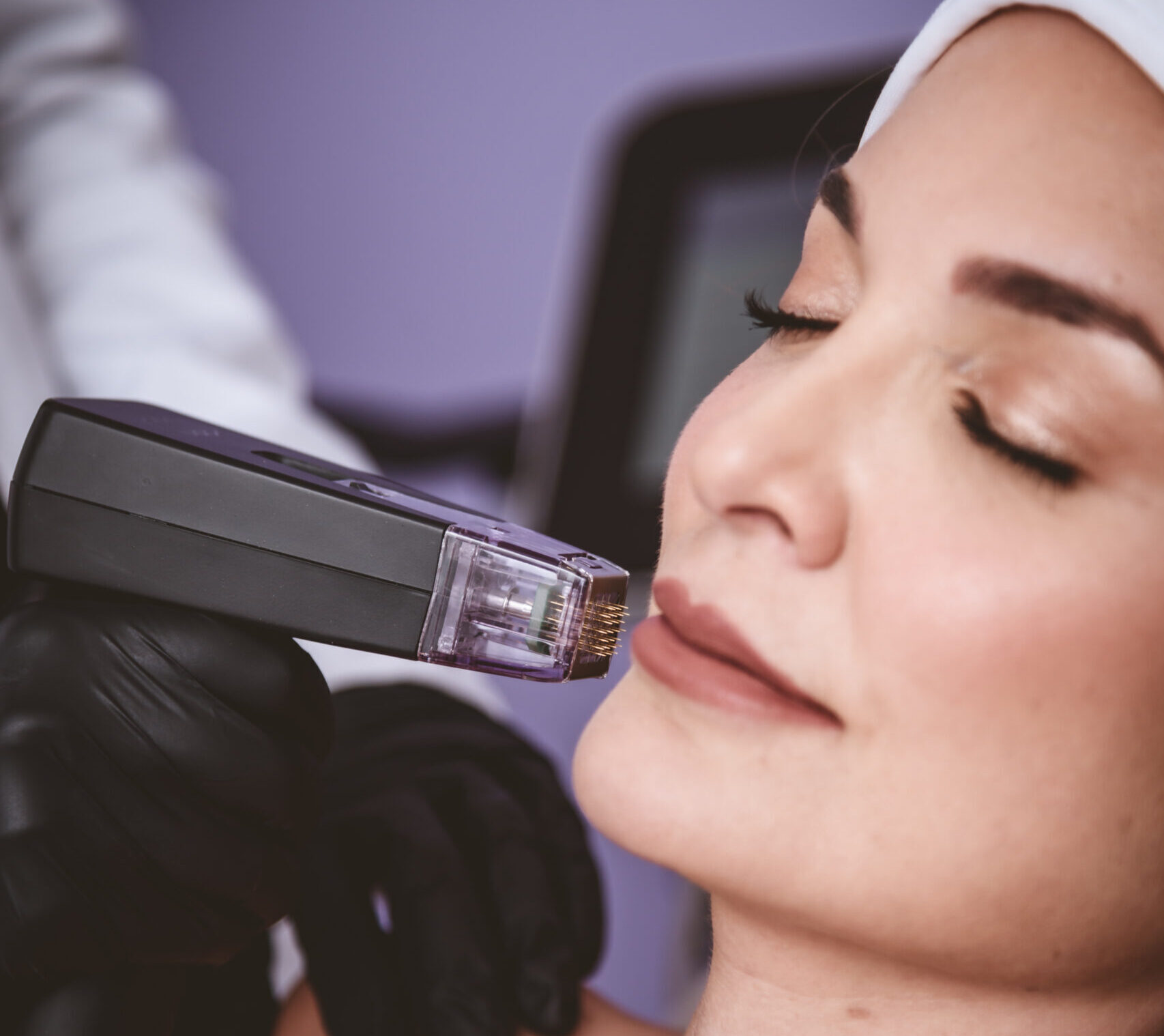 Facial Treatments