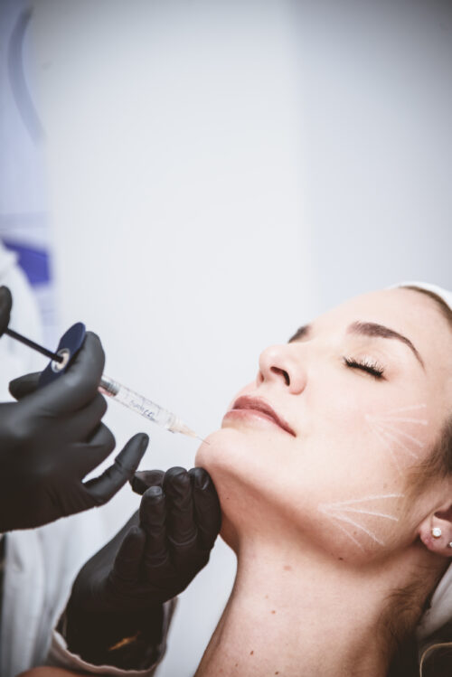 ARMONIZACIÓN FACIAL