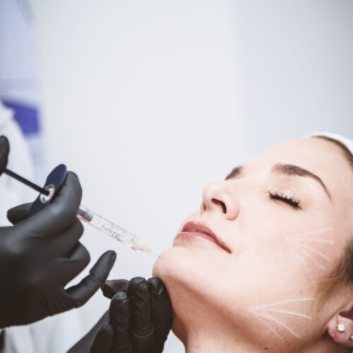 ARMONIZACIÓN FACIAL