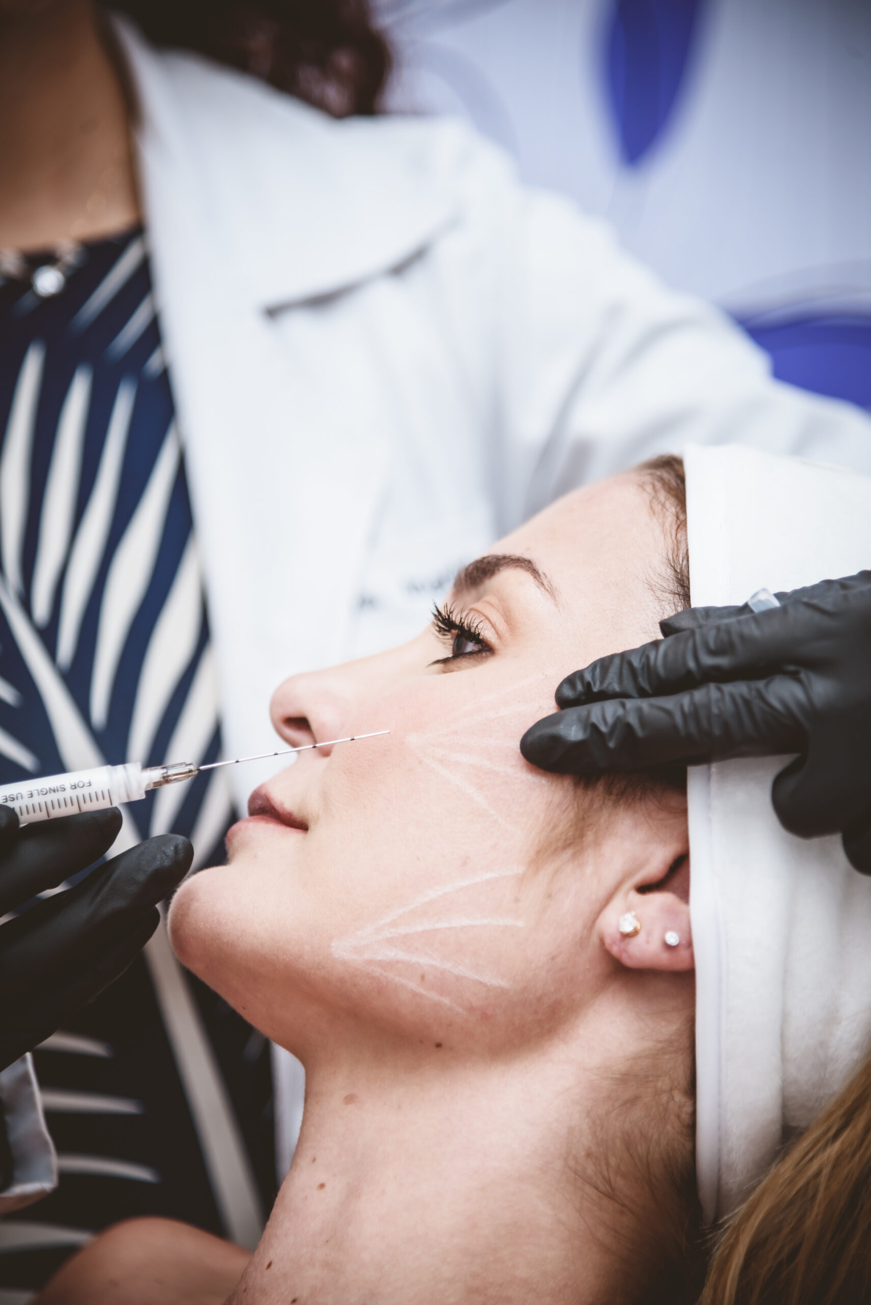 ARMONIZACIÓN FACIAL