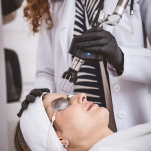 RESURFACING (FACIAL)