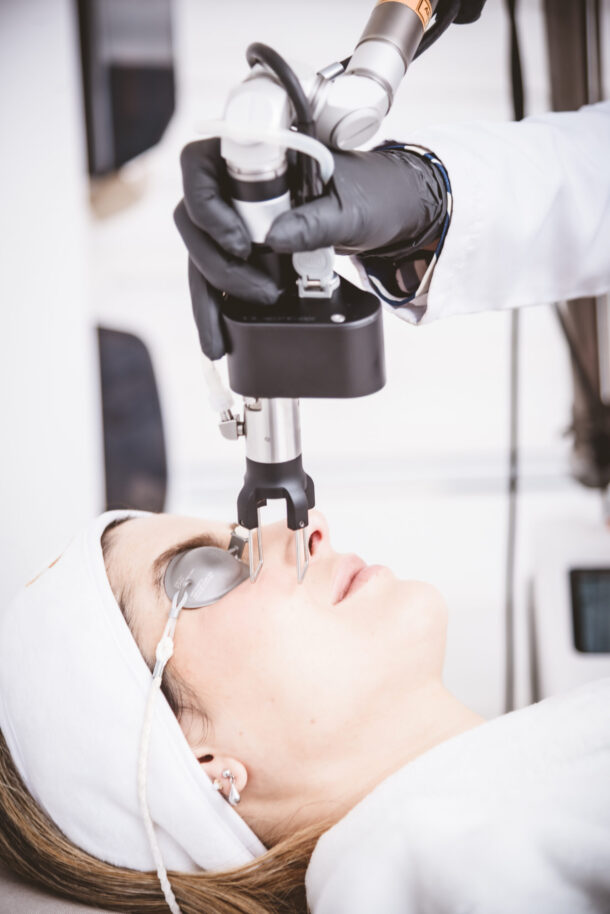 Laser CO₂ Resurfacing (Facial)