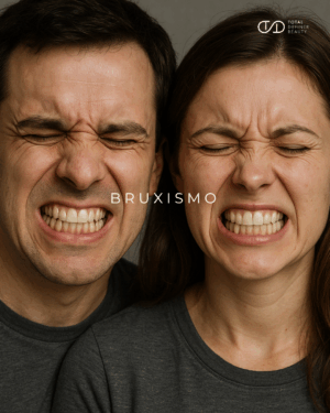 Tratamiento para el Bruxismo: Alivia la tensión y protege tu sonrisa