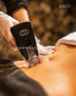 Morpheus Corporal: Remodelación, firmeza y regeneración sin cirugía