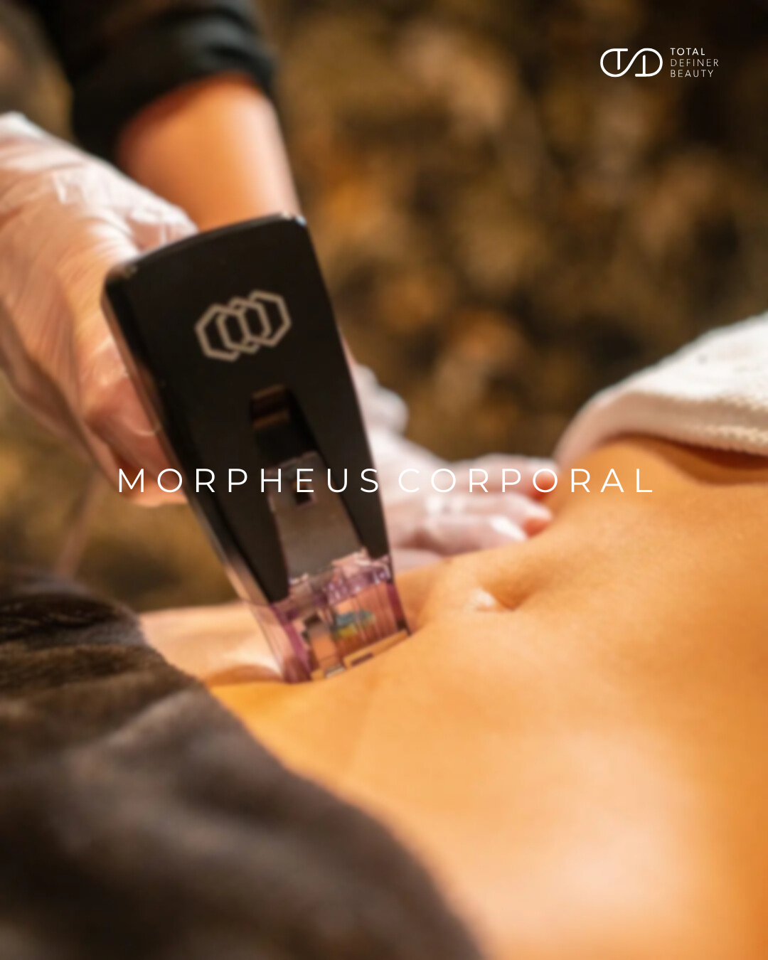 Morpheus Corporal: Remodelación, firmeza y regeneración sin cirugía