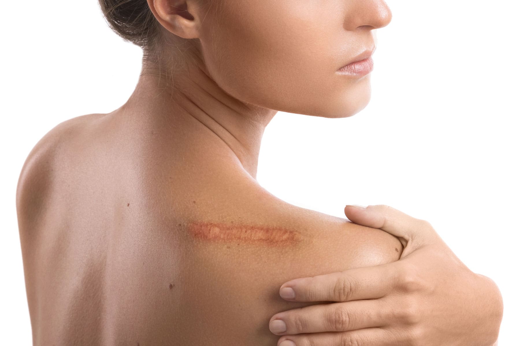 Scar care evaluation