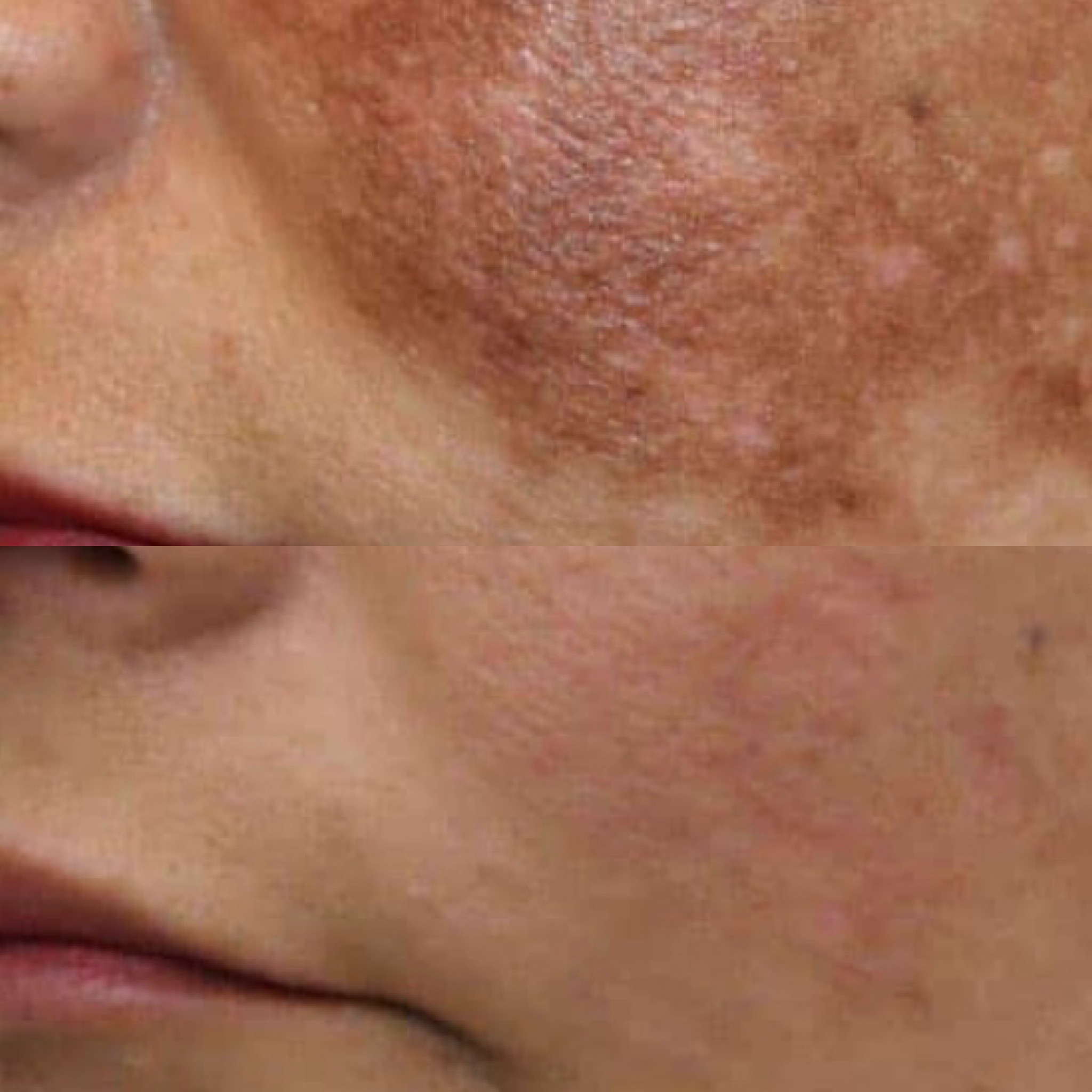 Scar treatment consultation