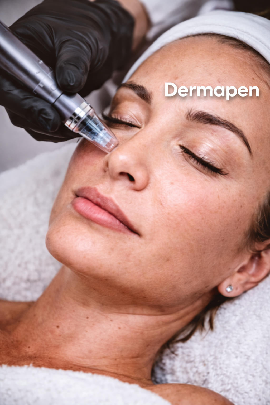Dermapen