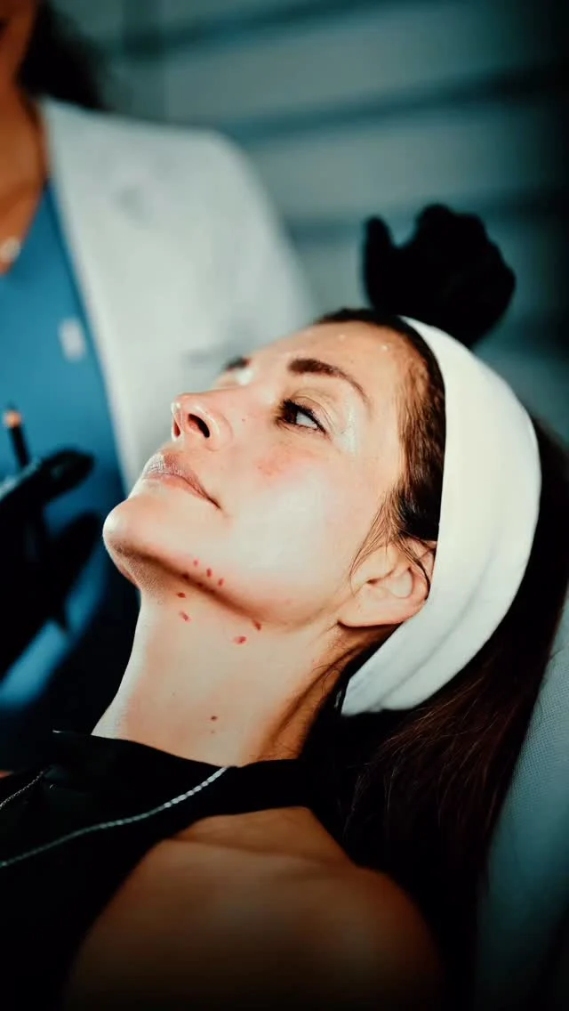 Nefertiti Lifting
Redefine tu mandíbula, eleva tu belleza.
Con toxina botulínica, logramos un cuello estilizado y un rostro más firme, sin cirugía.
Inspirado en la elegancia de la reina Nefertiti 👑

🔸 Resultados naturales
🔸 Procedimiento rápido
🔸 Sin tiempo de recuperación

💬 Agenda tu valoración hoy y descubre cómo realzar tu belleza sin perder tu esencia.

📍Calle 93 #14 55 piso 5 Chicó
📞 +57 3138825162