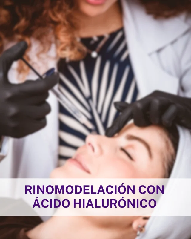 No es magia, es rinomodelación.

Sin cirugía.
Sin dolor.
Sin tiempo de incapacidad.

Solo unos minutos con ácido hialurónico bastan para:
✔️ Elevar la punta
✔️ Disimular el caballete
✔️ Dar simetría
✔️ Y sí… hacer que tu nariz se vea más fina de frente

💡 Porque cuando el dorso está recto, la nariz se estiliza.
A veces no necesitas quitar… solo saber dónde poner.

📩 Agenda tu valoración y te decimos cómo armonizar tu perfil sin bisturí.

#rinomodelacion #acidohialuronico #narizperfecta #armonizacionfacial #sinbisturi #tdbeautyspa #rinomodelacionbogota #beautywithoutfilters