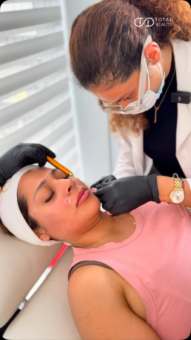 No es un relleno. No es toxina. Es ciencia líquida para tu piel.
Te presento Profhilo, el skin booster que ha revolucionado la medicina estética.

Su fórmula con ácido hialurónico ultrapuro no busca volumen… busca calidad de piel.

💧 Hidrata en profundidad
🧬 Estimula colágeno y elastina
🌟 Mejora firmeza, textura y luminosidad
⏳ Disminuye líneas finas y signos de flacidez

En solo dos sesiones puedes notar una piel más viva, más firme y visiblemente renovada, sin alterar tus rasgos y sin cambiar tu expresión.

No se nota que te hiciste algo… pero se nota que te hiciste algo.

📍Disponible en nuestro spa médico.
📩 Escríbenos para agendar tu valoración y empezar a transformar tu piel desde adentro.

#profhilo #skinbooster #acidohialuronico #rejuvenecimiento #pielradiante #tdbeautyspa #antiaging #esteticafacial